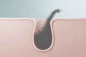 블랙-헤드-제거-방법