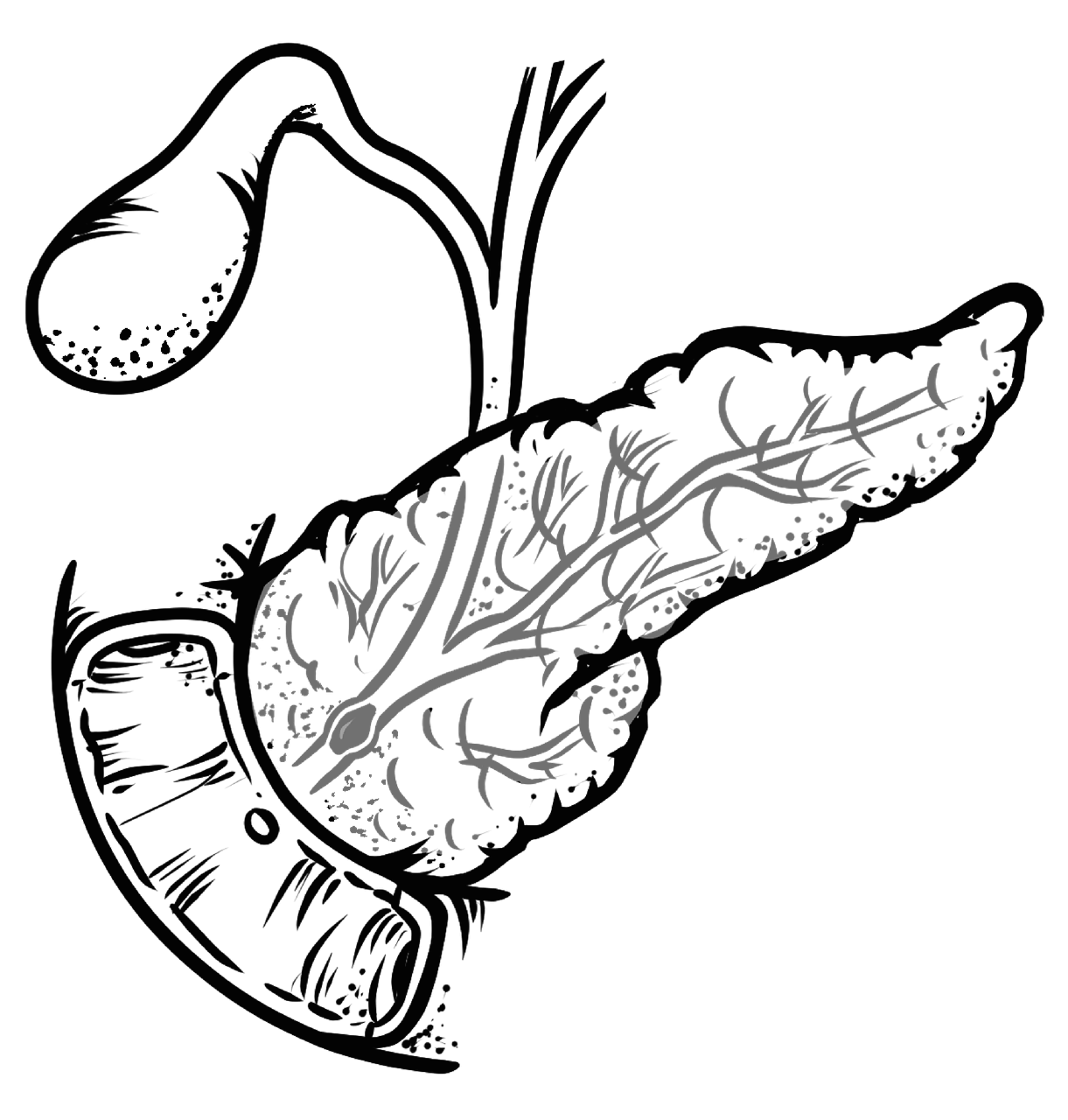 오른쪽 복부 통증의 원인, 급성담낭염 증상, 원인, 치료까지 정리