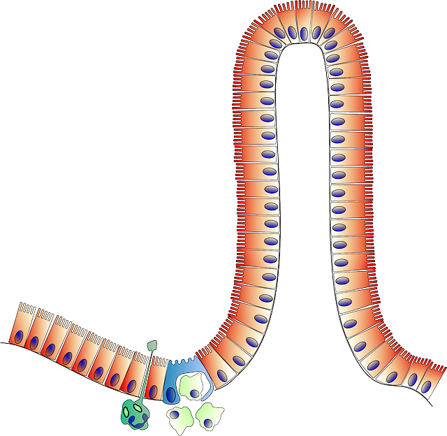자극성 장 증후군