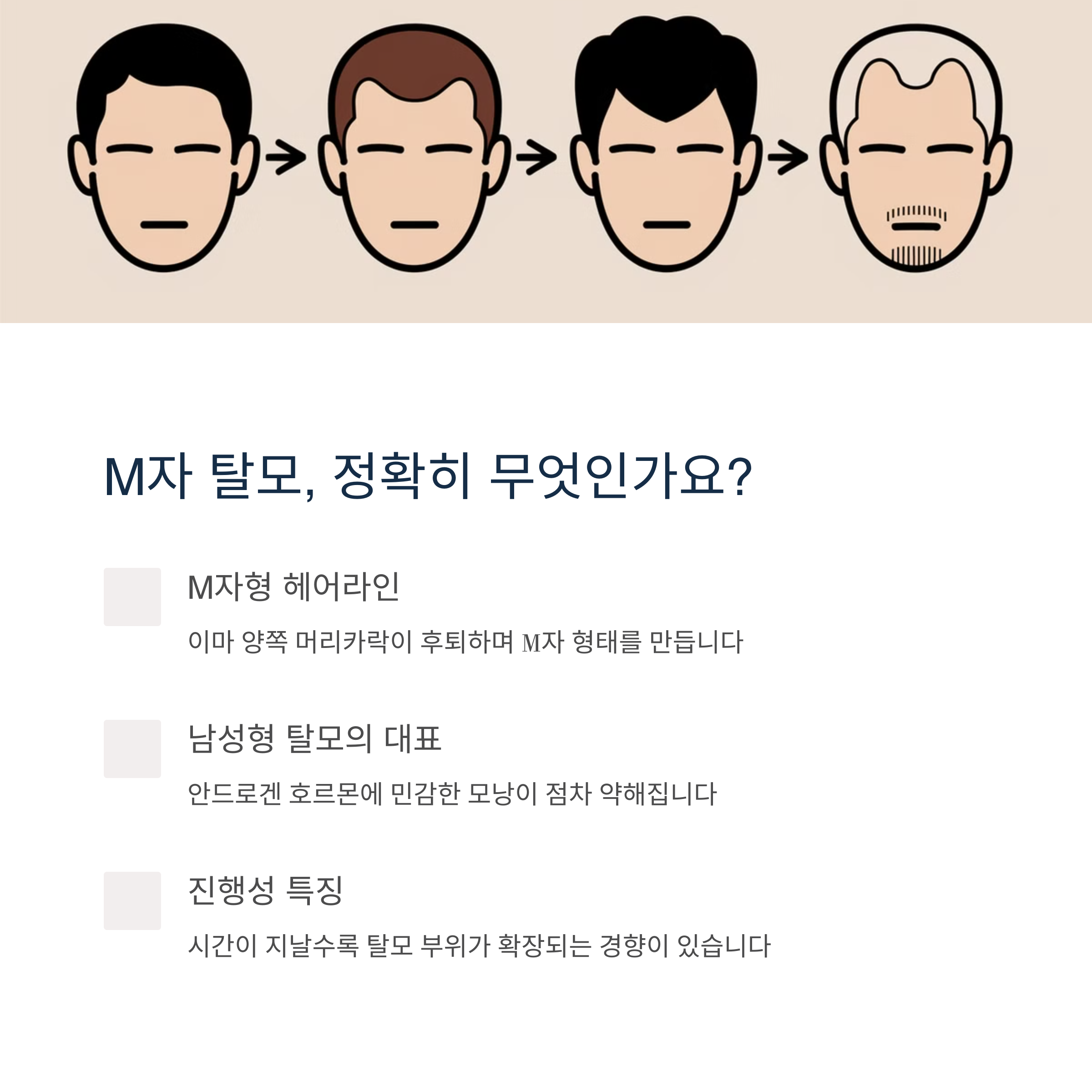 여러 탈모의 모습의 남자 캐릭터 이미지