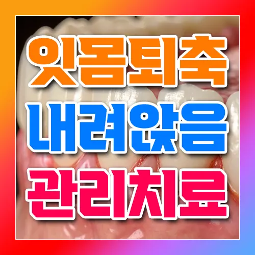 잇몸퇴축 내려앉음 관리치료