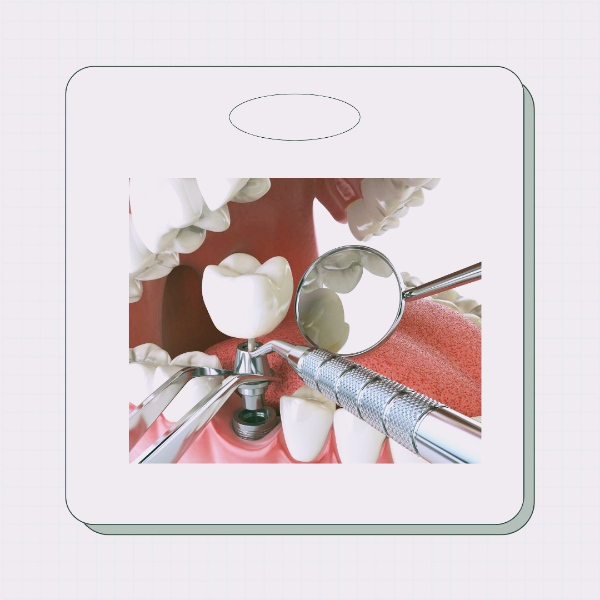 경기도 임플란트 지원금