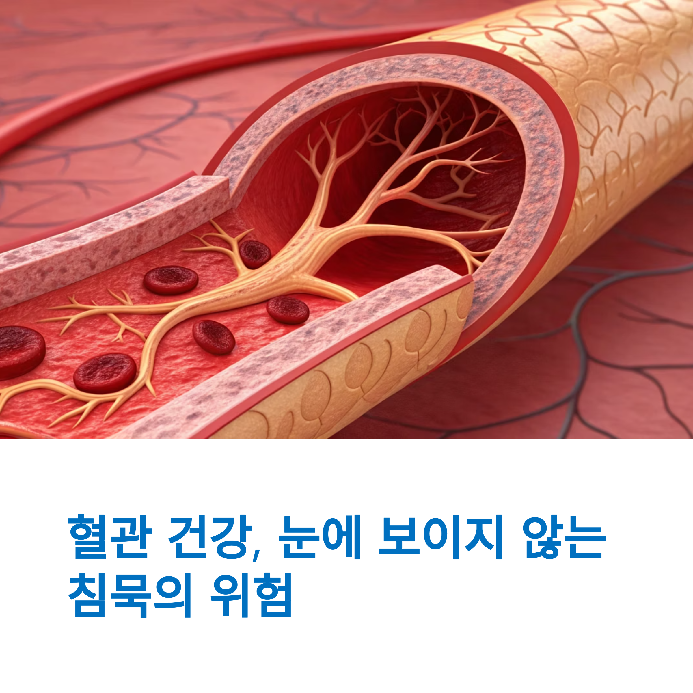 혈관 건강이 생명을 지킨다