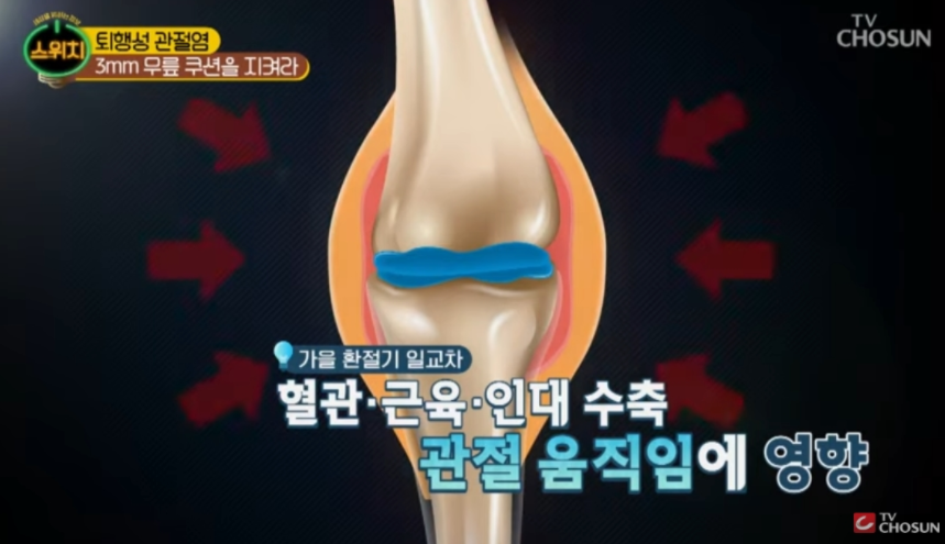 콘드로이친 관절염 효과