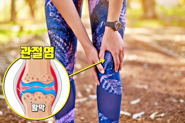 관절염 증상 원인, 여름에 많이 걸리는 병, 건강 팁줌 매일꿀정보