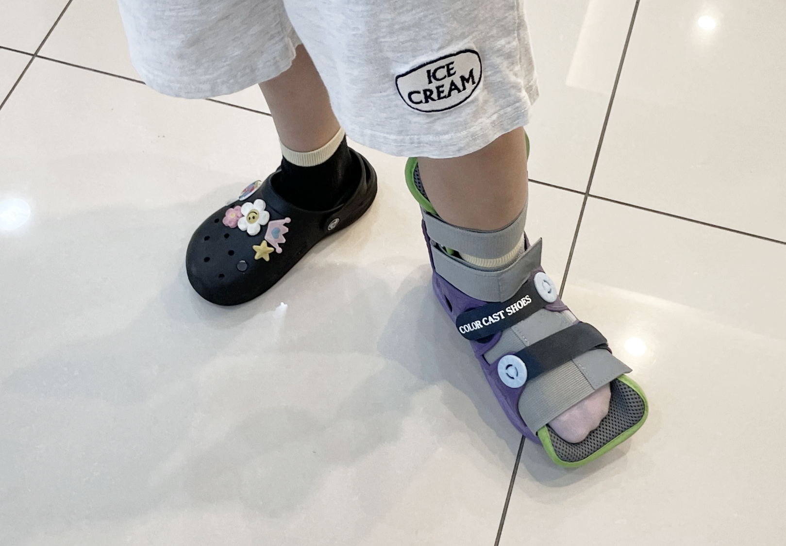 발목 접질렸을때 한 부목 사진