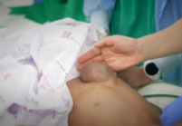 가슴밖으로 심장이 튀어나온 환자 사진