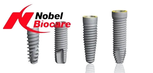 임플란트 가격 차이나는 이유, 브레네막