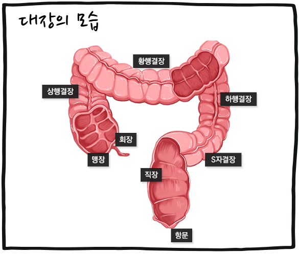 대장내시경33