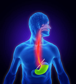 역류성 식도염 증상 10가지, 자연치료 방법