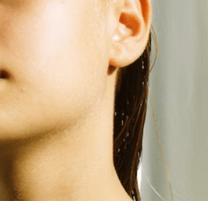 모공 줄이는 방법 - 식단 관리