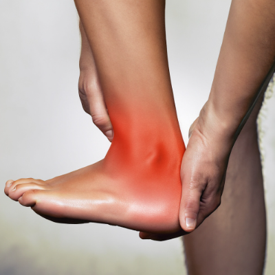 2.발목 삐었을때 빨리 낫는법