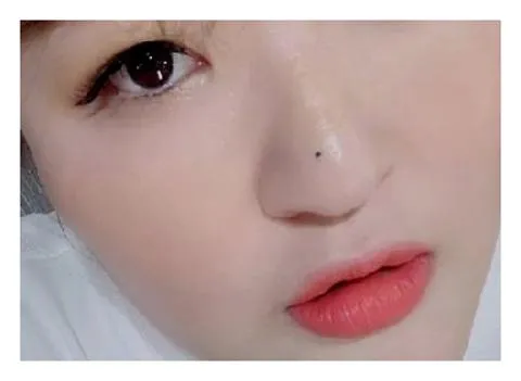 점생기는 이유