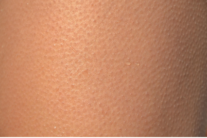 초기 임산부 피부 변화, 트러블과 색소침착 관리법