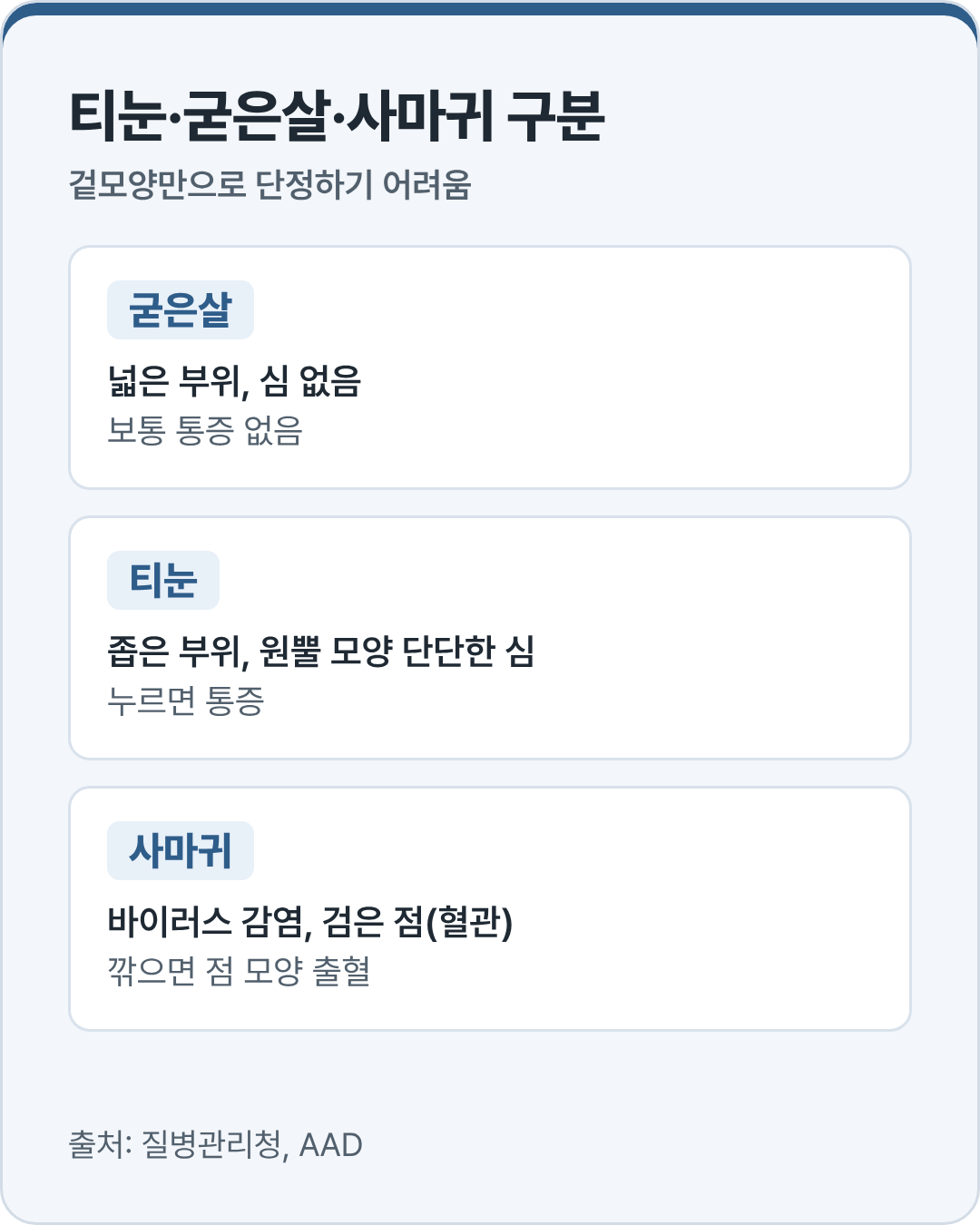 티눈 굳은살 사마귀의 특징을 나란히 비교한 표