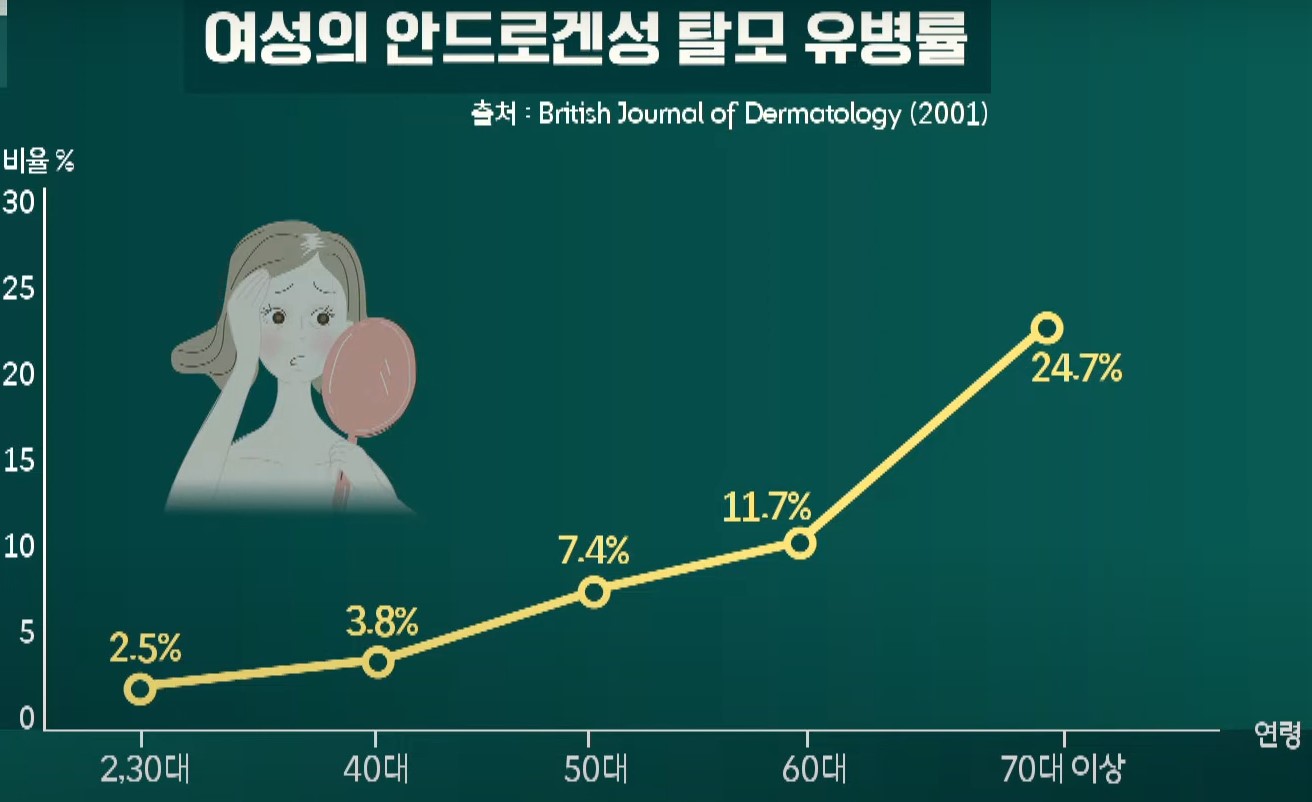 여성 탈모 유병률