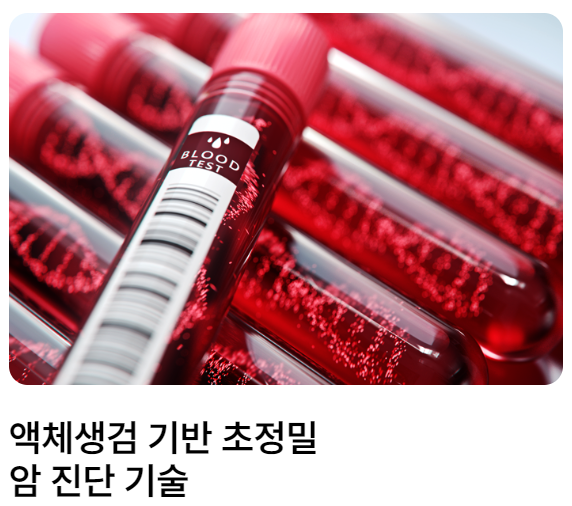 아이엠비디엑스-공모주