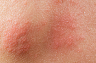 ๋์ํฌ์ง ์๋ฐฉ์ ์ข
๊ฐ๊ฒฉ