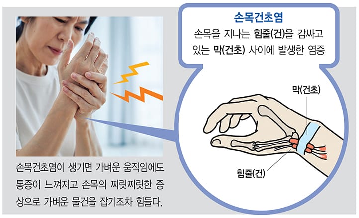 손목보호대 필요한 상황 고르는법
