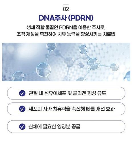 관절주사