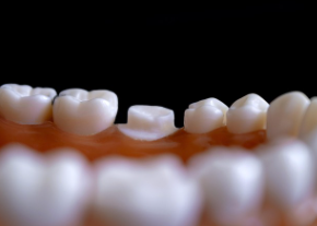 이빨 빠지는 꿈