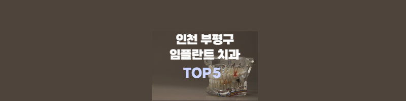 인천부평구-치과추천-썸네일
