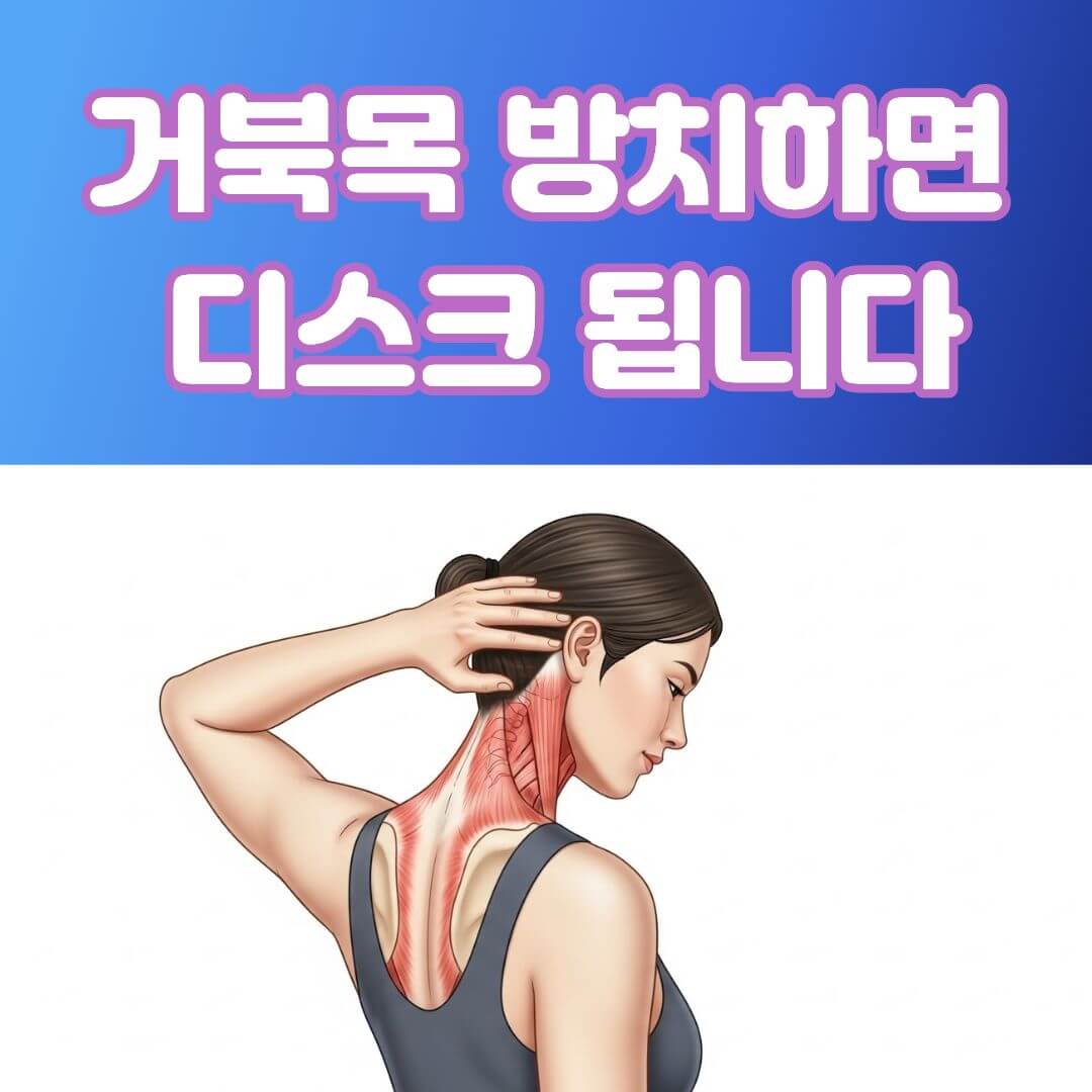 거북목 스트레칭 3분 루틴: 통증 잡는 가장 쉬운 방법