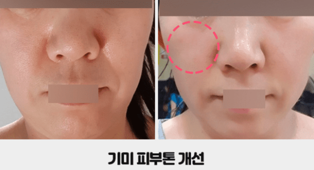 고혼진 실제후기