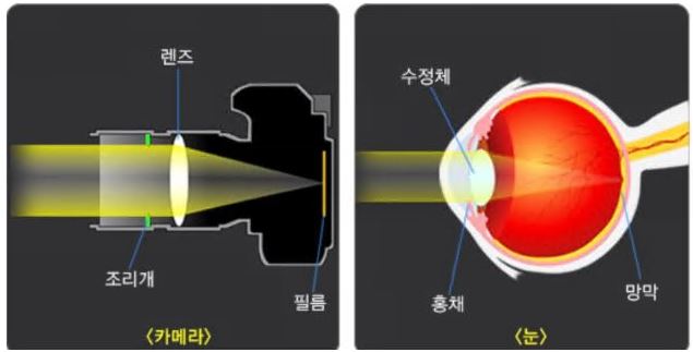 백내장-수술가격