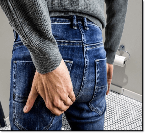 엉덩이 화농성 한선염 남성