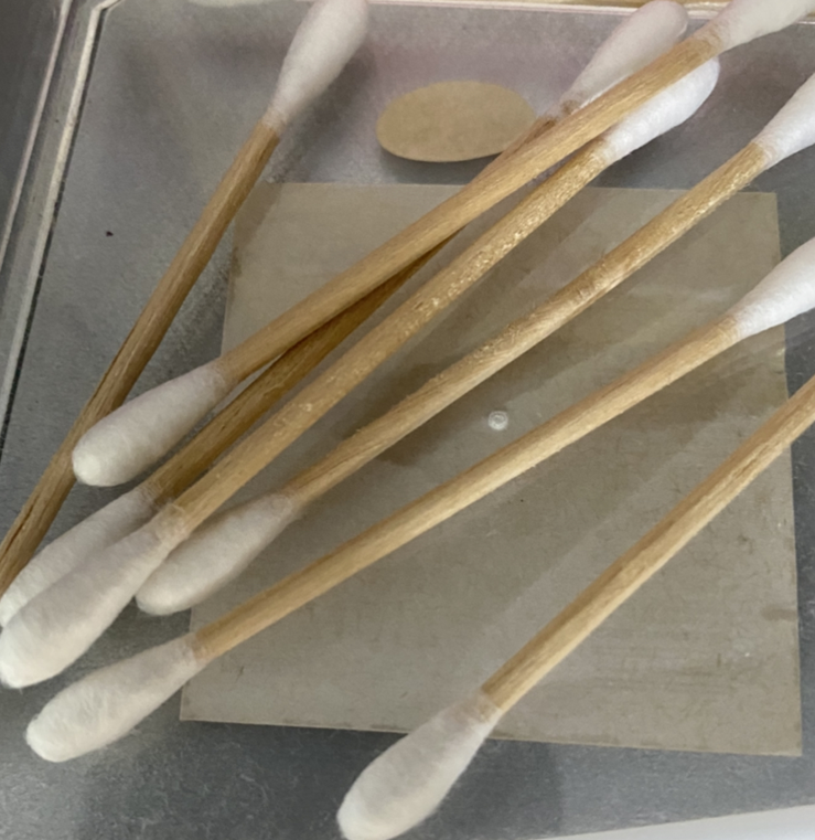 편도결석 원인 및 제거법