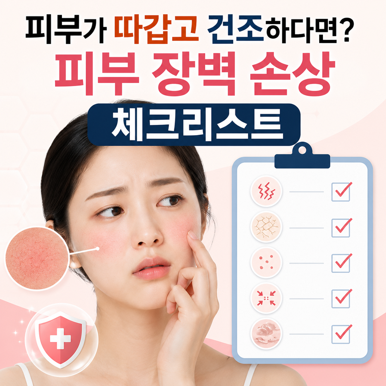 피부장벽손상