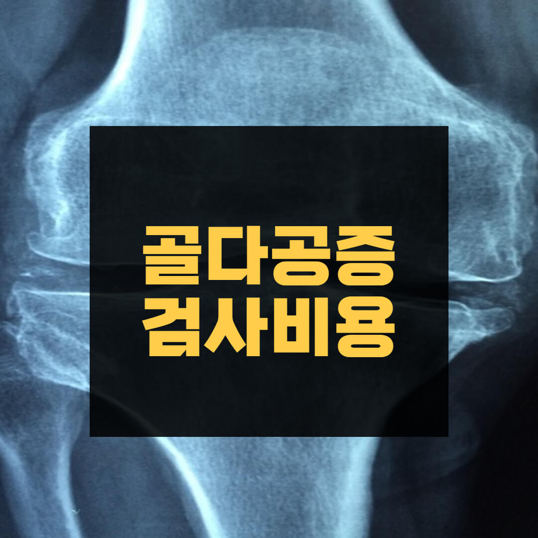 골다공증 검사비용
