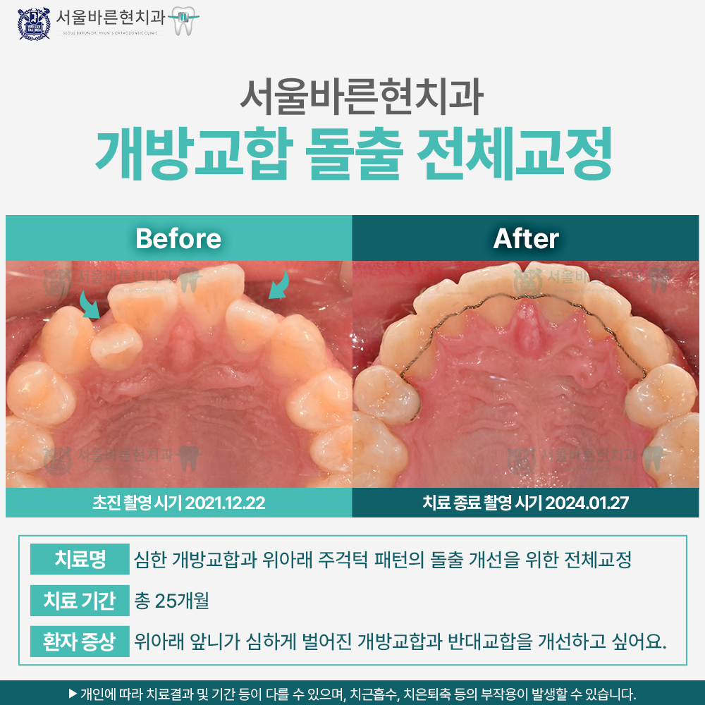 부산교정치과