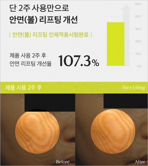 리베니프 리마지 실프팅 앰플 효능, 성분, 부작용, 후기