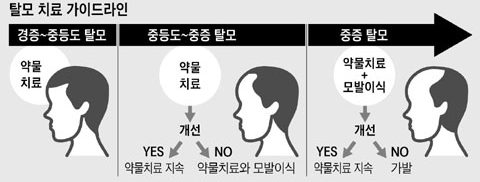 진행도별 탈모치료법 약물 치료에서부터 시작해서 모발이식 가발순으로 진행하여야 한다.