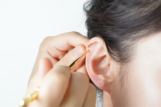 귓볼 주름 프랭크 징후