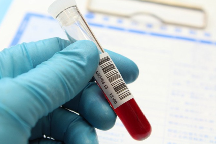 혈액이 들어간 시험관.