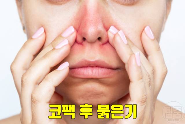 코팩 후 관리 코팩 모공 넓어짐 부작용 붉은기