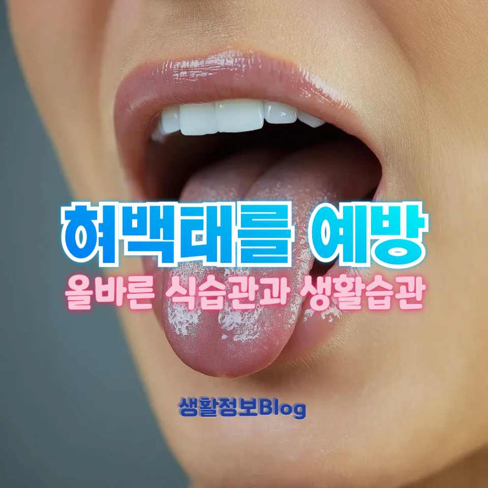 혀백태를 예방
