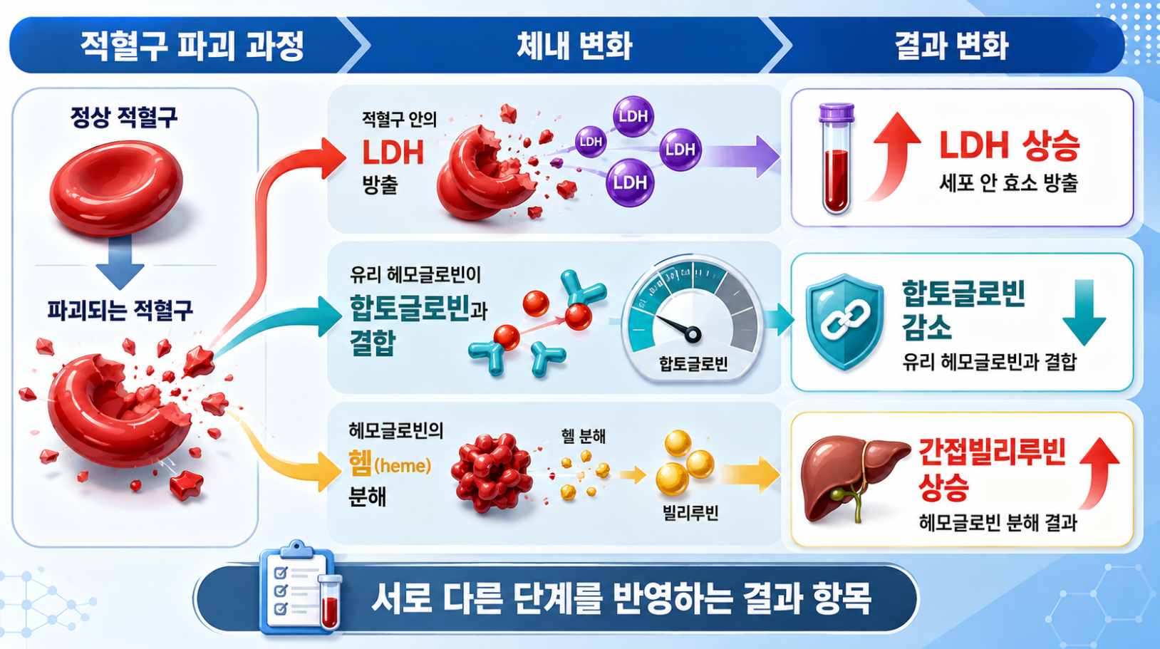 적혈구 파괴 과정에서 LDH 상승, 합토글로빈 감소, 간접빌리루빈 상승이 나타나는 이유를 단계별로 설명한 의료 인포그래픽