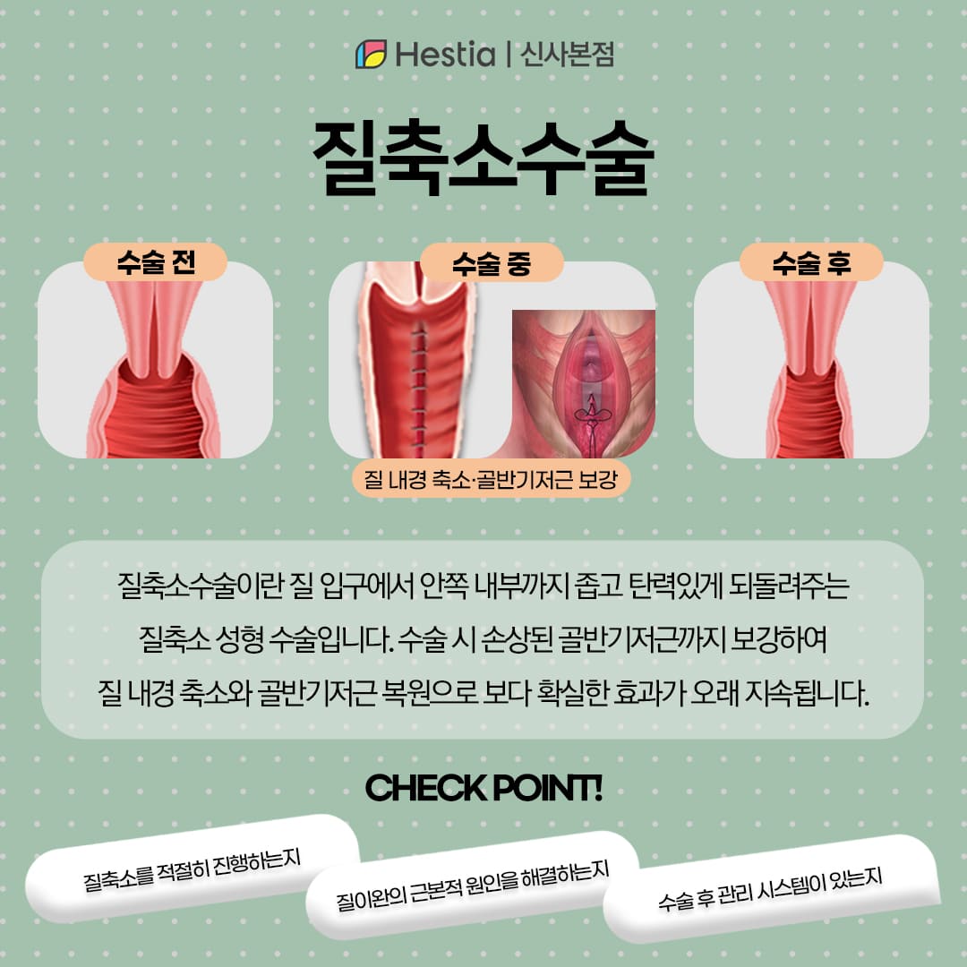 골반근육 복원까지 필요하다면?