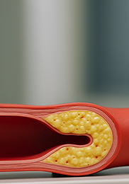 뇌졸중 전조증상