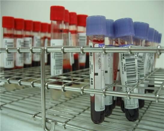 피검사로 알수있는것