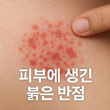 피부에 생긴 붉은 반점, 노화의 흔적? 위험 신호? 혈관종 vs 자반증, 헷갈리면 안 되는 이유