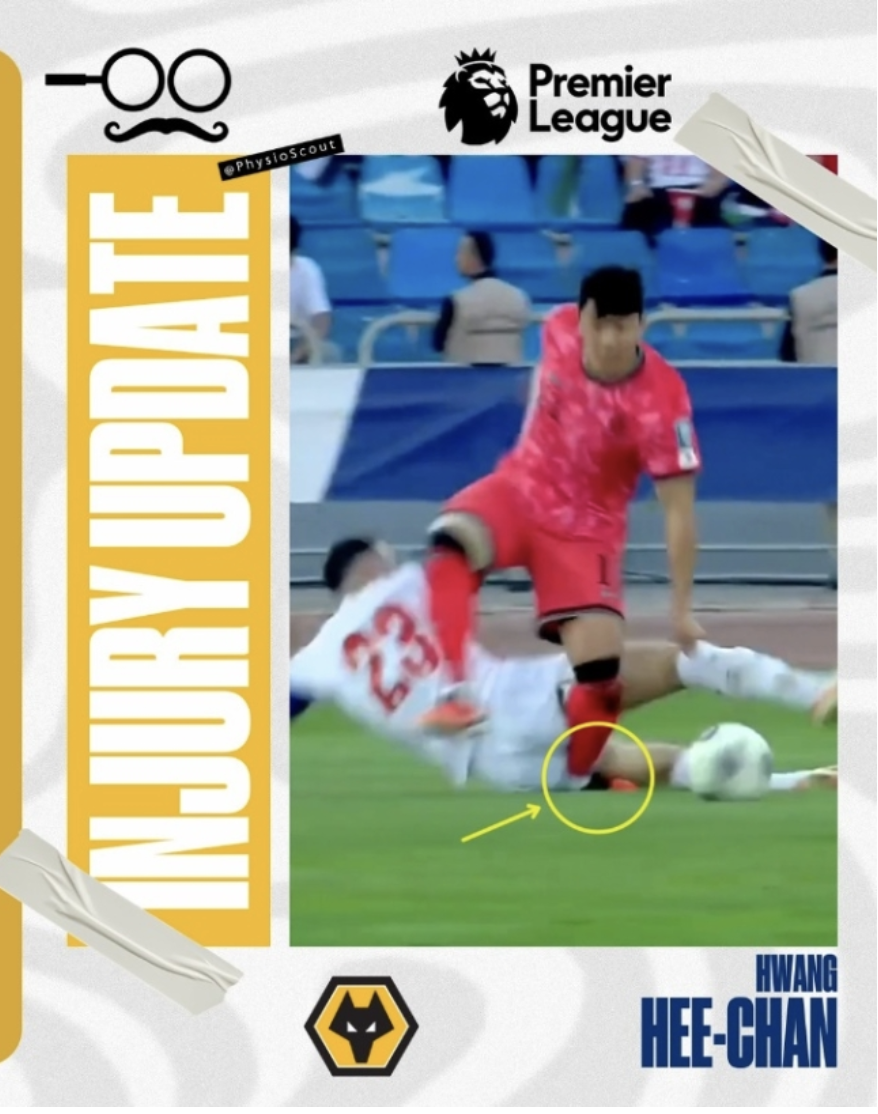 울버햄프턴 원더러서 공격수 황희찬이 국가대표 경기에서 입은 부상으로 인해 발목 수술을 받을 수 있다고 밝힌 피지오 스카우트(사진출처.피지오 스카우트 SNS)