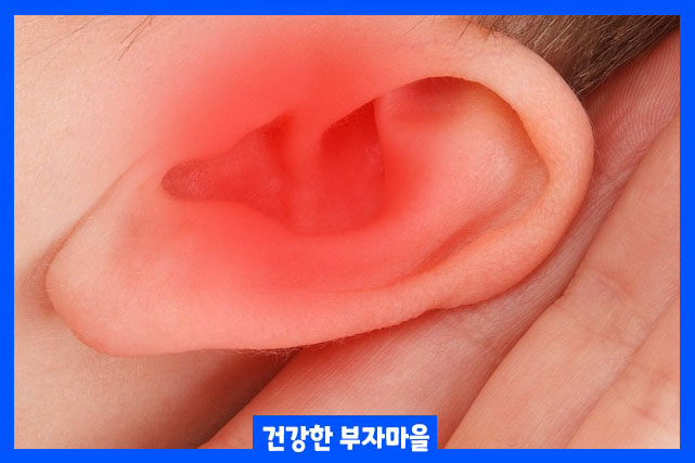청각장애 등급 판정기준 : 농인 및 난청인 차이점