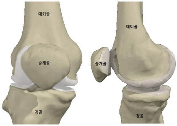 무릅관절구성