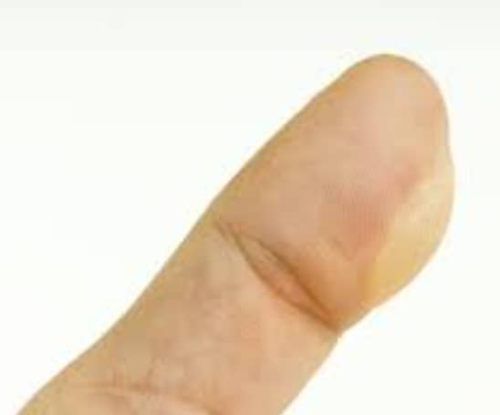 2도 화상 이미지