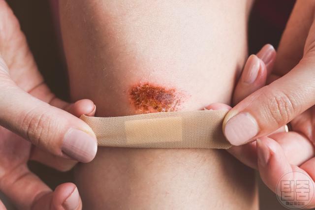 콜라겐 결핍증 부족증상 상처 자연치유